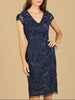 Cap Sleeve Embellished Dress